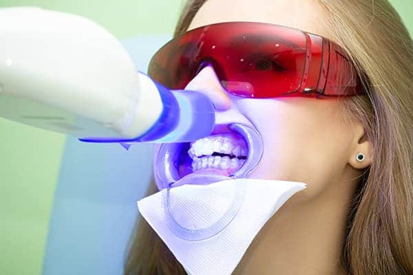 Laser teeth whitening treatments Corby