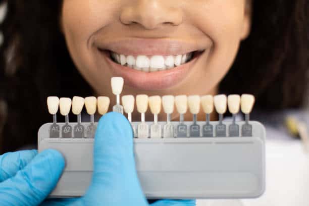 Laser Teeth Whitening: Exploring the Longevity of Your Brighter Smile Corby