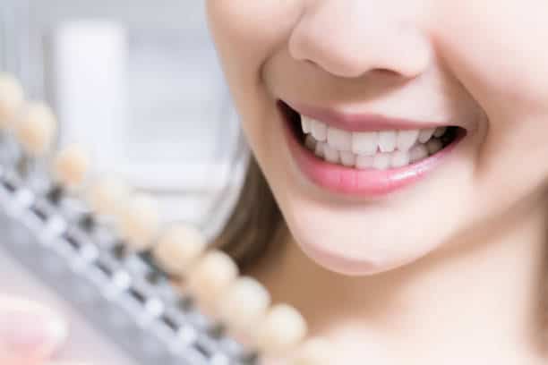 Teeth Whitening Kings Norton Corby