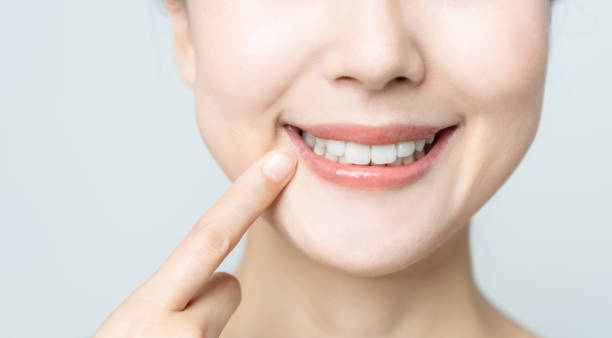 Comparing the Pain Factor: Laser Teeth Whitening vs. Zoom Teeth Whitening Corby