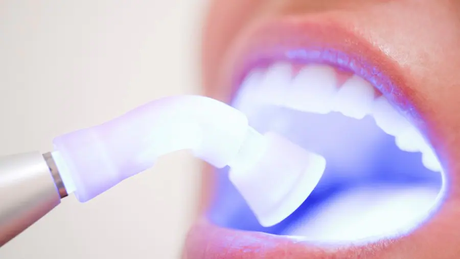 Teeth Whitening Aylesbury Corby