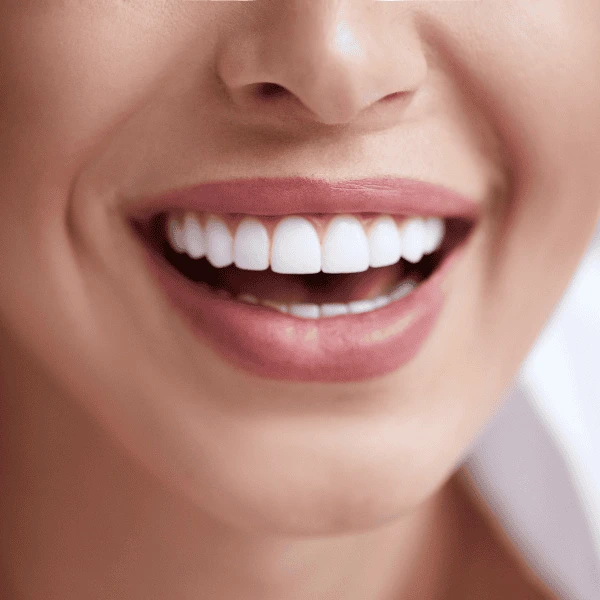 Get A whiter smile fast! Book with LA Teeth Whitening today! Corby