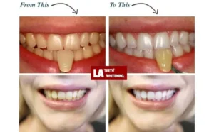 I Don't Want My Teeth Too White Corby