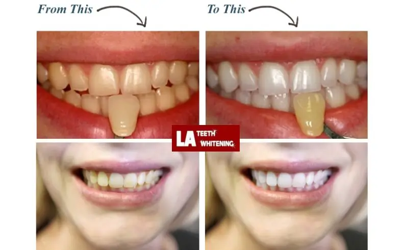 I Don't Want My Teeth Too White Corby