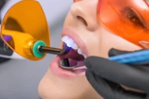 Relaxed woman receiving safe Laser Teeth Whitening for discoloured teeth Corby